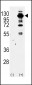 PI3KCG Antibody (Center)